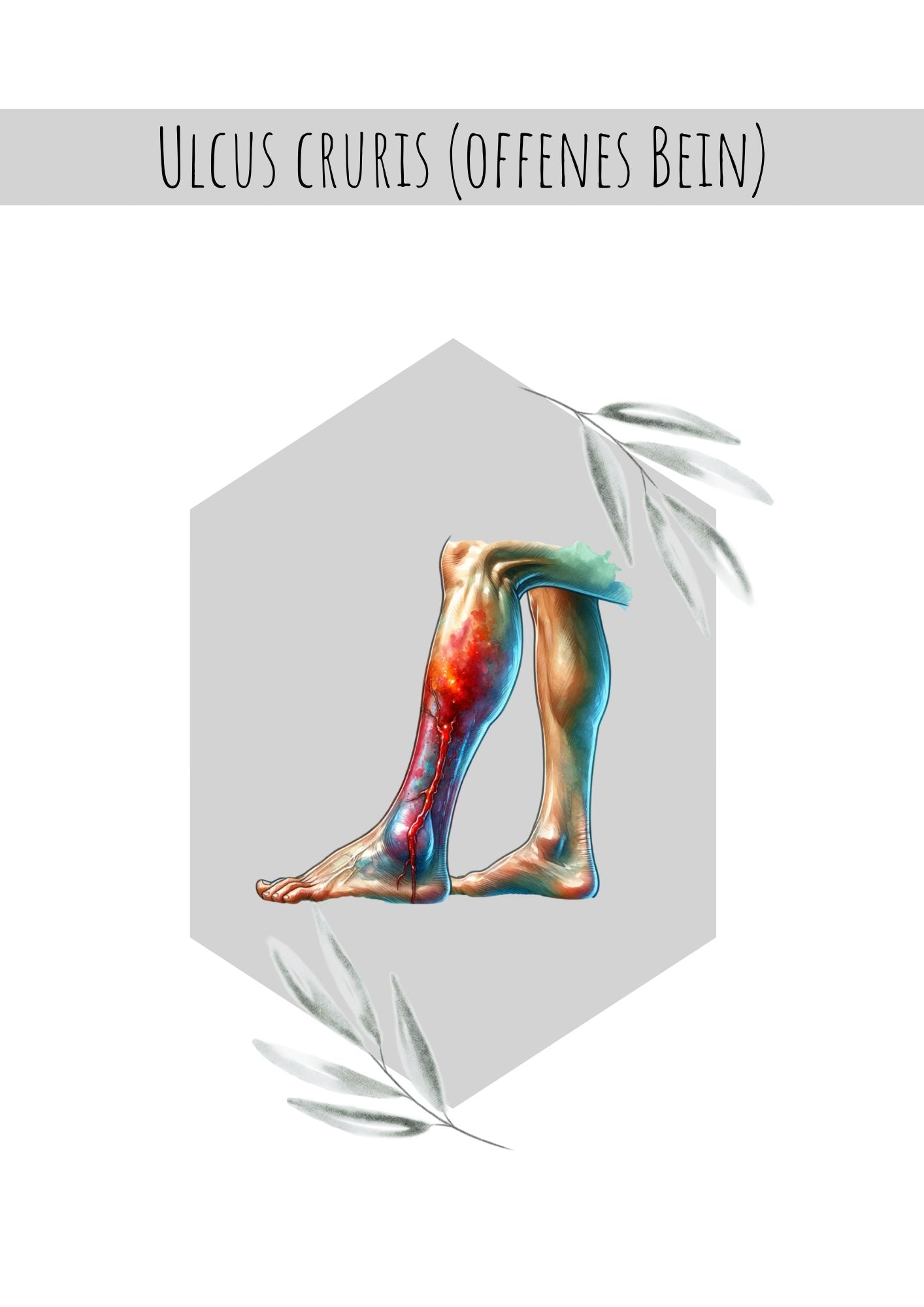 Ulcus cruris (offenes Bein)