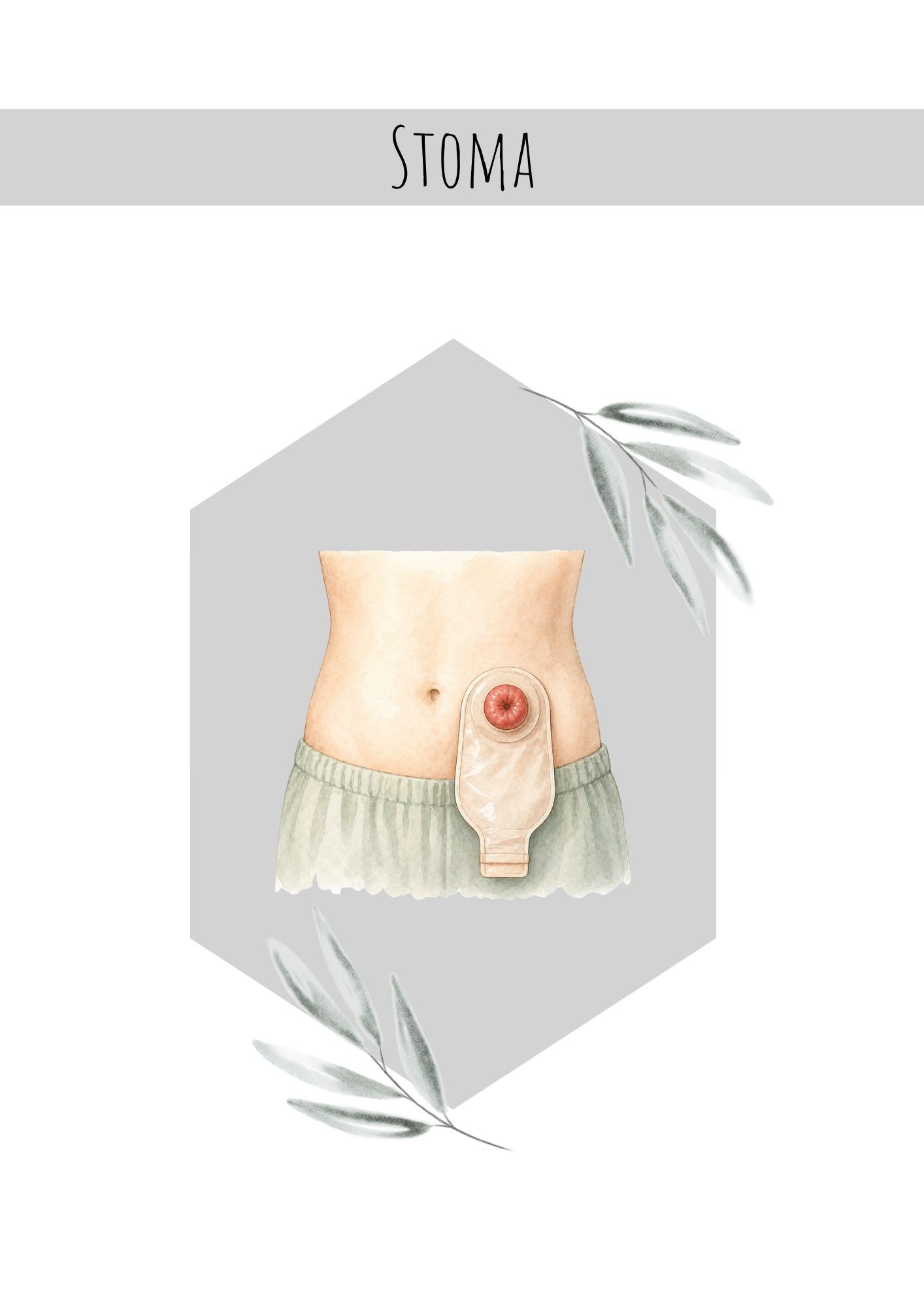 Stoma